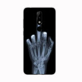 the skeleton hand case for motorola z3