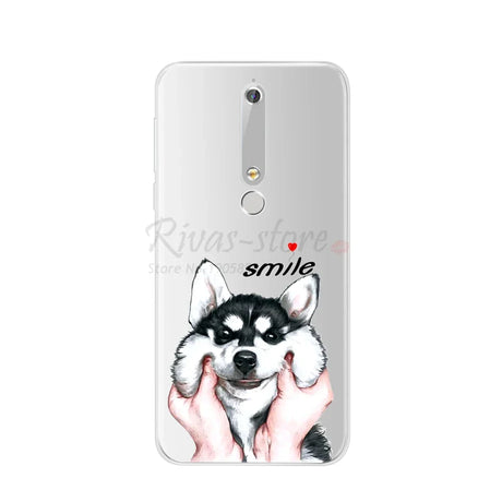 Phone case with husky design.