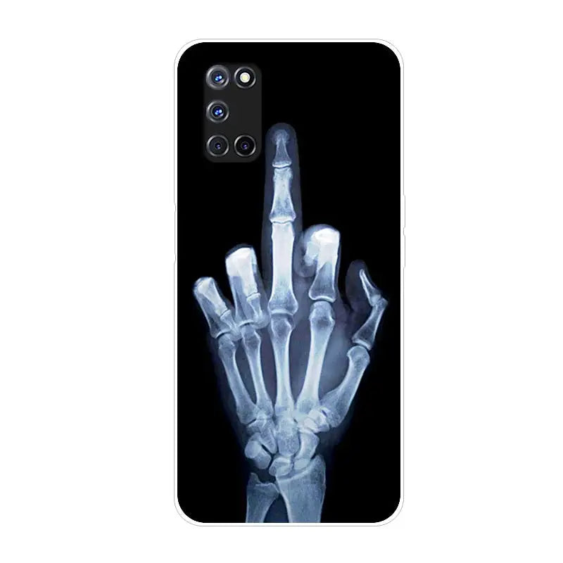 a hand xray phone case